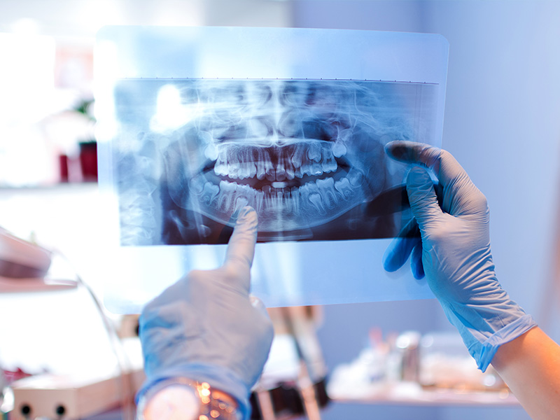 Simply Smiles Dental in Harlem | Cosmetic Dentistry, Emergency Treatment and Digital Radiography